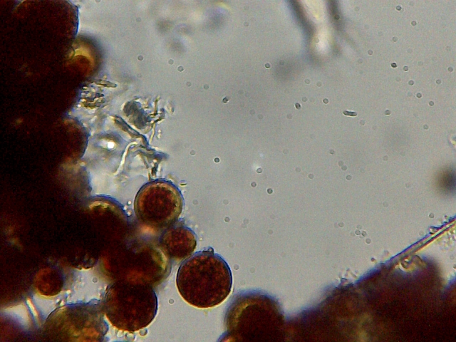 Haematococcus pluvialis e philodina